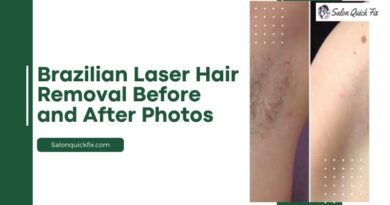 Brazilian Laser Hair Removal Before and After Photos