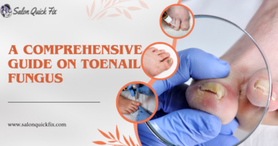 A Comprehensive Guide on Toenail Fungus